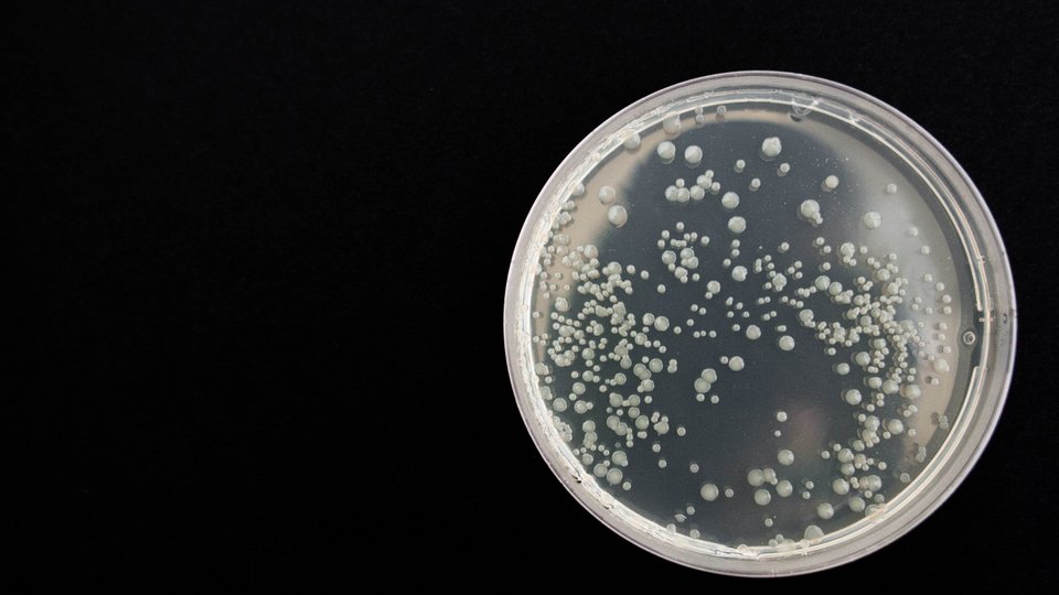 Bakterienkolonien in einer Petrischale | Pixabay